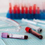 Die Entdeckung der Blutgruppen – Eine medizinische Revolution